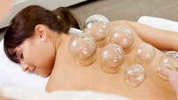 <b>5. </b>A detailed description of how Chinese Cupping is done